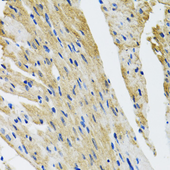 Immunohistochemistry - COPB2 Polyclonal Antibody 