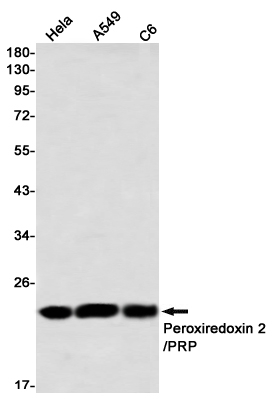Western blot detection of Peroxiredoxin 2/PRP in Hela,A549,C6 using Peroxiredoxin 2/PRP Rabbit mAb(1:1000 diluted)