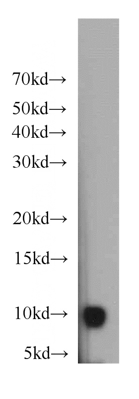 HeLa cells were subjected to SDS PAGE followed by western blot with Catalog No:111346(HIGD1A antibody) at dilution of 1:500