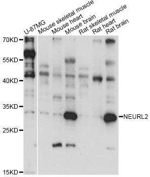 Western blot - NEURL2 Polyclonal Antibody 