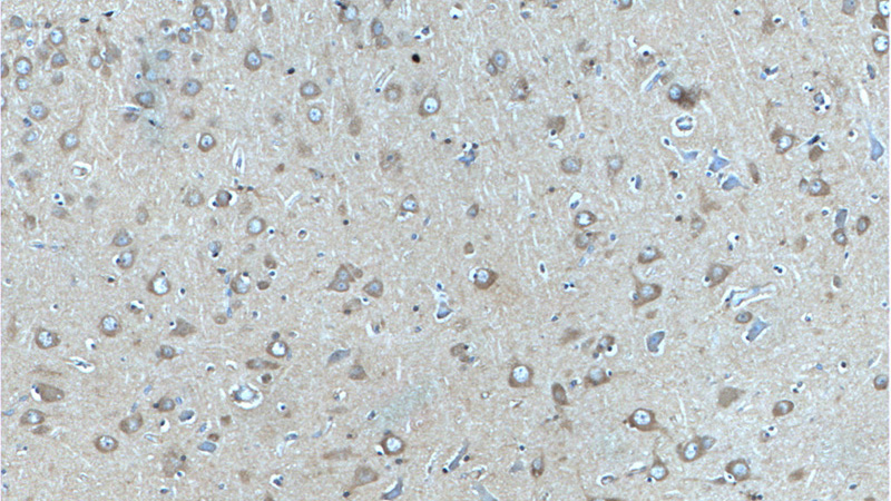 Immunohistochemistry of paraffin-embedded human brain tissue slide using Catalog No:108758(CACNA1D Antibody) at dilution of 1:50 (under 10x lens)