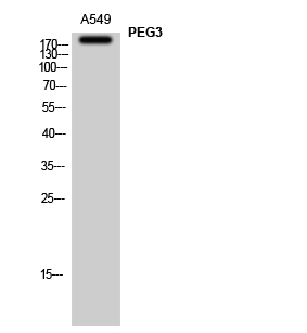 Fig1:; Western Blot analysis of A549 cells using PEG3 Polyclonal Antibody
