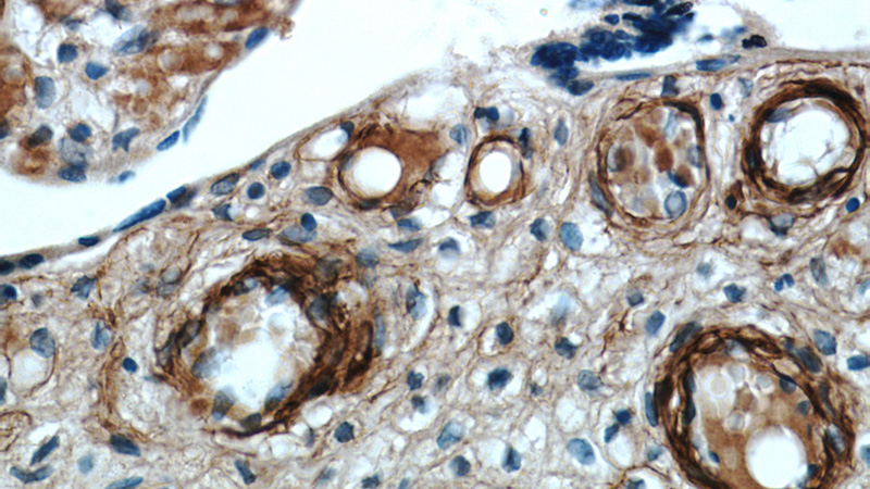 Immunohistochemical of paraffin-embedded human placenta using Catalog No:116735(VEGFA antibody) at dilution of 1:50 (under 40x lens)