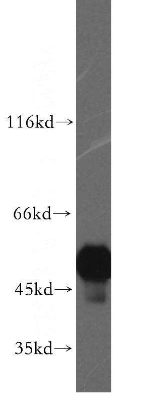 HepG2 cells were subjected to SDS PAGE followed by western blot with Catalog No:116452(TXNDC5 antibody) at dilution of 1:300