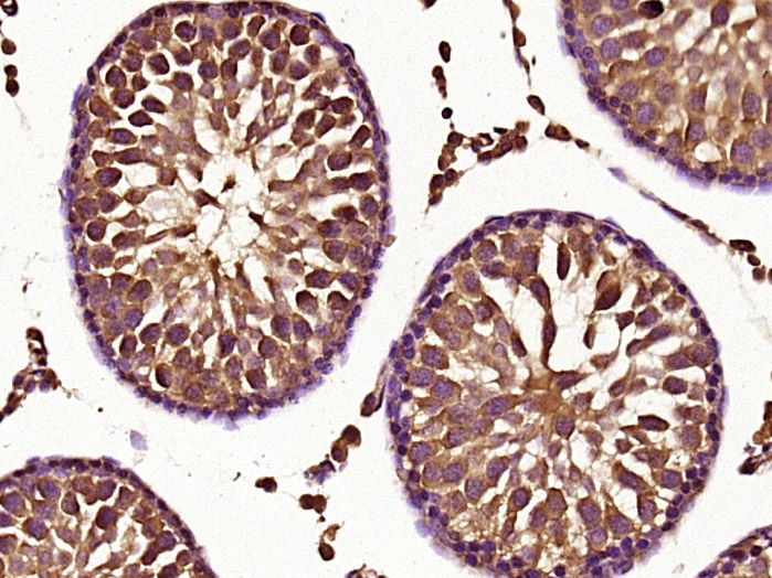 Fig1: Paraformaldehyde-fixed, paraffin embedded (rat testis tissue); Antigen retrieval by boiling in sodium citrate buffer (pH6.0) for 15min; Block endogenous peroxidase by 3% hydrogen peroxide for 20 minutes; Blocking buffer (normal goat serum) at 37℃ for 30min; Antibody incubation with (KLHL18) Polyclonal Antibody, Unconjugated at 1:400 overnight at 4℃, followed by operating according to SP Kit(Rabbit) (sp-0023) instructionsand DAB staining.