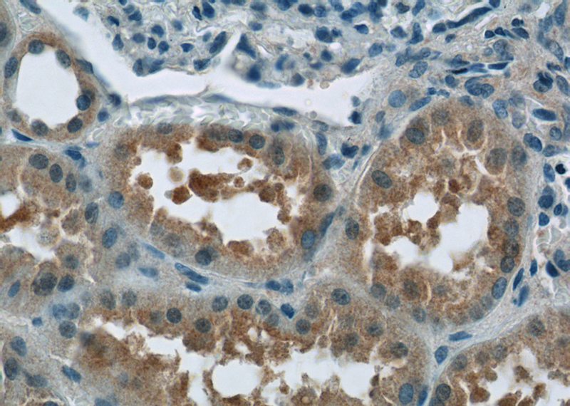 Immunohistochemistry of paraffin-embedded human kidney tissue slide using Catalog No:108648(C12orf65 Antibody) at dilution of 1:50 (under 40x lens)