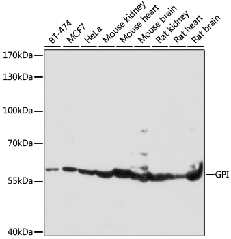 Western blot - GPI Polyclonal Antibody 