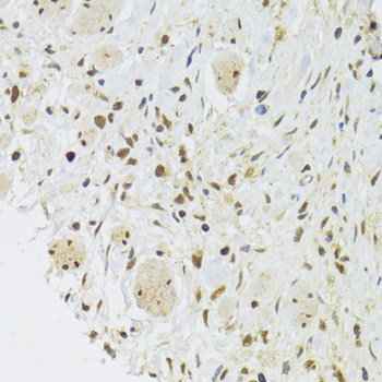 Immunohistochemistry - EFTUD2 Polyclonal Antibody 