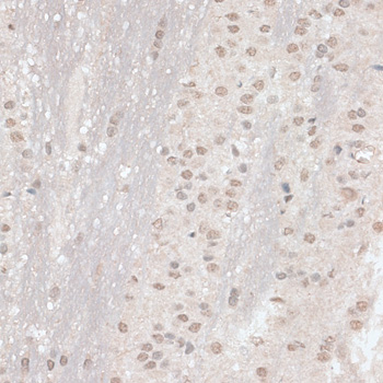 Immunohistochemistry - RBM17 Polyclonal Antibody 
