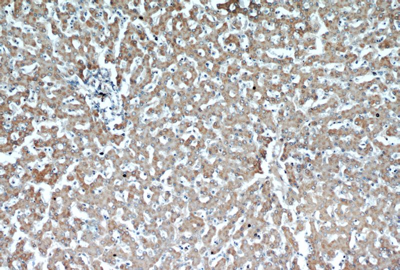 Immunohistochemical of paraffin-embedded human liver using Catalog No:115631(ST7 antibody) at dilution of 1:50 (under 10x lens)