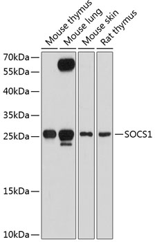 Western blot - SOCS1 Polyclonal Antibody 