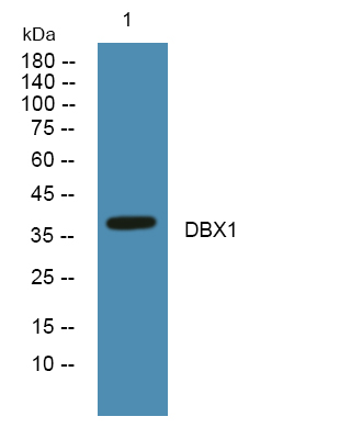 Fig1:; Western blot analysis of lysates from K562 cells, primary antibody was diluted at 1:1000, 4°over night.