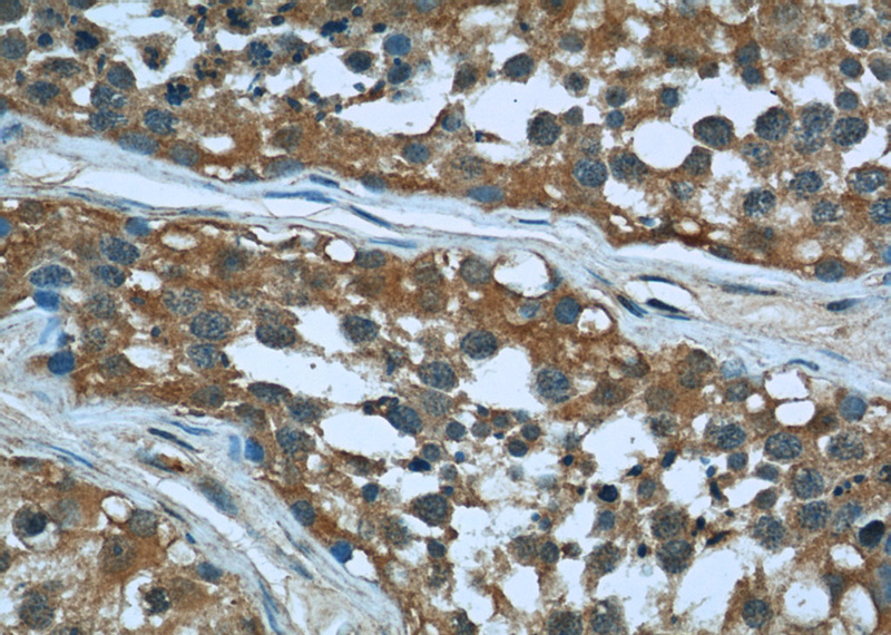 Immunohistochemical of paraffin-embedded human testis using Catalog No:107168(CFL1 antibody) at dilution of 1:50 (under 40x lens)