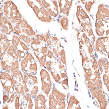 Immunohistochemistry - KIF14 Polyclonal Antibody 