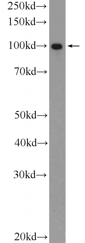 HeLa cells were subjected to SDS PAGE followed by western blot with Catalog No:115708(STIM2 Antibody) at dilution of 1:1000