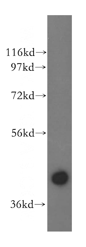 K-562 cells were subjected to SDS PAGE followed by western blot with Catalog No:116575(UROD antibody) at dilution of 1:500