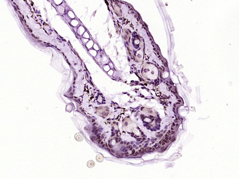 Fig3: Paraformaldehyde-fixed, paraffin embedded (Mouse skin); Antigen retrieval by boiling in sodium citrate buffer (pH6.0) for 15min; Block endogenous peroxidase by 3% hydrogen peroxide for 20 minutes; Blocking buffer (normal goat serum) at 37℃ for 30min; Antibody incubation with (FOXN1) Polyclonal Antibody, Unconjugated at 1:400 overnight at 4℃, followed by operating according to SP Kit(Rabbit) (sp-0023) instructionsand DAB staining.