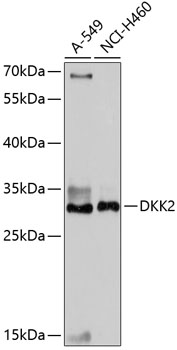 Western blot - DKK2 Polyclonal Antibody 