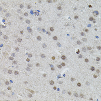 Immunohistochemistry - MYCN Polyclonal Antibody 