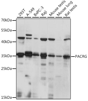 Western blot - PACRG Polyclonal Antibody 