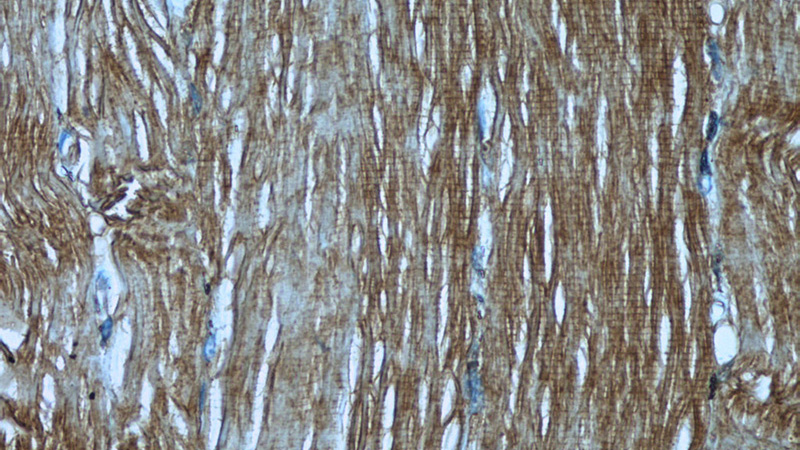 Immunohistochemistry of paraffin-embedded human skeletal muscle tissue slide using Catalog No:107642(TRAPPC9,NIBP Antibody) at dilution of 1:50 under 40x lens