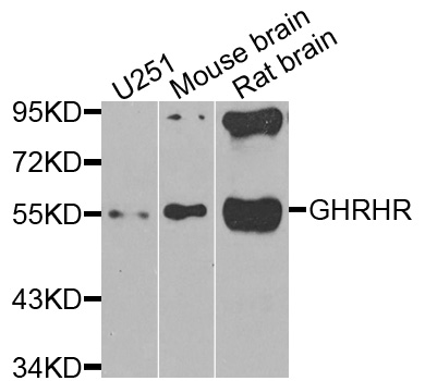 Western blot - GHRHR Polyclonal Antibody 
