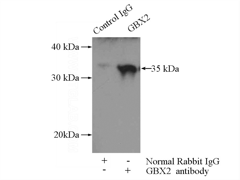 IP Result of anti-GBX2 (IP:Catalog No:110896, 4ug; Detection:Catalog No:110896 1:300) with HeLa cells lysate 3000ug.