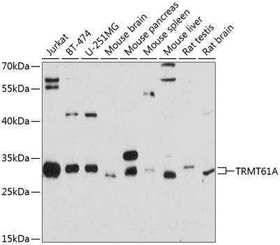 Western blot - TRMT61A Polyclonal Antibody 