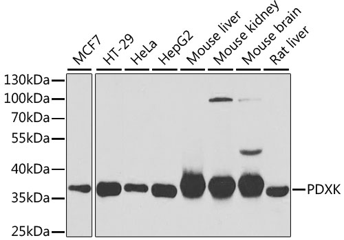 Western blot - PDXK Polyclonal Antibody 