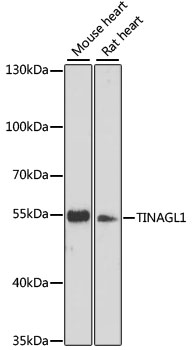 Western blot - TINAGL1 Polyclonal Antibody 