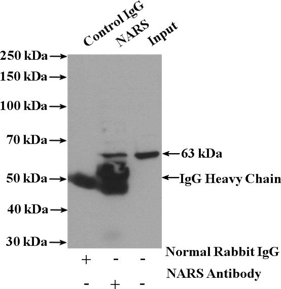 IP Result of anti-NARS (IP:Catalog No:112955, 4ug; Detection:Catalog No:112955 1:500) with HepG2 cells lysate 4000ug.