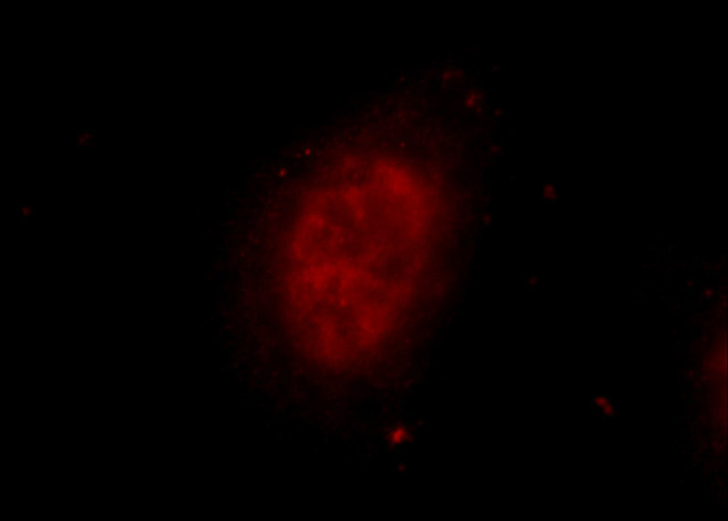 Immunofluorescent analysis of HeLa cells using Catalog No:117162(ZNF326 Antibody) at dilution of 1:25 and Rhodamine-Goat anti-Rabbit IgG