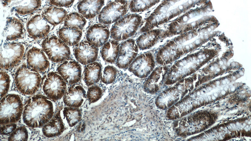 Immunohistochemistry of paraffin-embedded human colon tissue slide using Catalog No:112196(LEO1 Antibody) at dilution of 1:50 (under 10x lens)