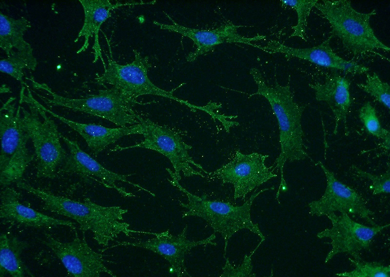 Immunofluorescent analysis of NIH/3T3 cells using Catalog No:114346(nectin 4 Antibody) at dilution of 1:50 and Alexa Fluor 488-congugated AffiniPure Goat Anti-Rabbit IgG(H+L)