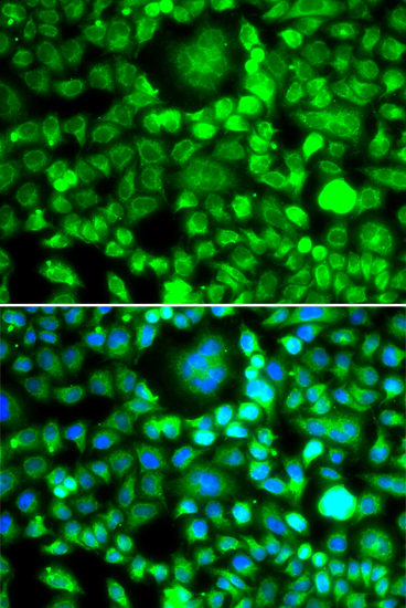 Immunofluorescence - BLID Polyclonal Antibody 