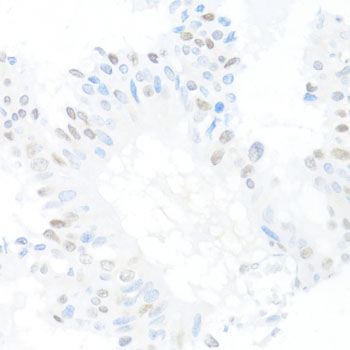 Immunohistochemistry - CREM Polyclonal Antibody 