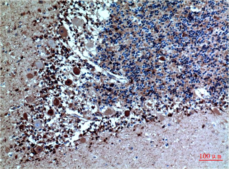 Immunohistochemical analysis of paraffin-embedded Human Brain Tissue usingCystatin C Mouse mAb diluted at 1:200.