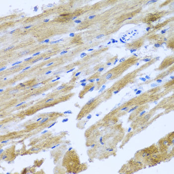 Immunohistochemistry - MOK Polyclonal Antibody 