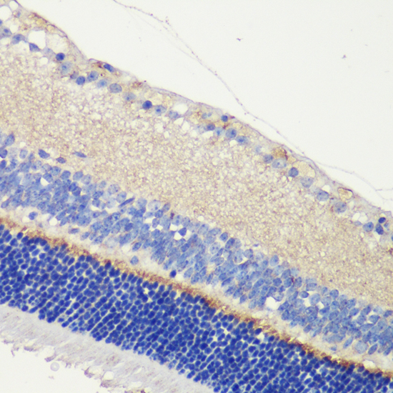 Immunohistochemistry - ANO2 Polyclonal Antibody 