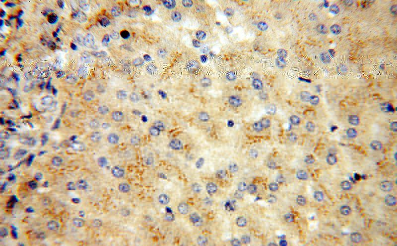 Immunohistochemical of paraffin-embedded human liver using Catalog No:116759(VDBP,GC antibody) at dilution of 1:100 (under 40x lens)