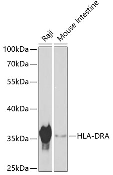 Western blot - HLA-DRA Polyclonal Antibody 