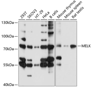 Western blot - MELK Polyclonal Antibody 
