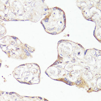Immunohistochemistry - OPRM1 Polyclonal Antibody 
