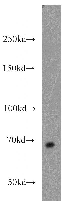 HepG2 cells were subjected to SDS PAGE followed by western blot with Catalog No:112102(KLHL3 antibody) at dilution of 1:800