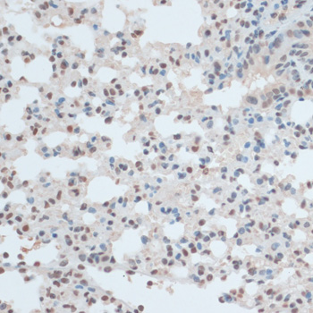 Immunohistochemistry - ZNF433 Polyclonal Antibody 