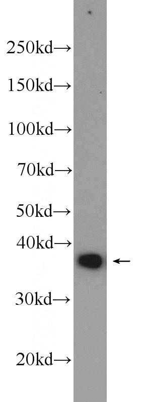 HeLa cells were subjected to SDS PAGE followed by western blot with Catalog No:114825(RPRD1B Antibody) at dilution of 1:1000