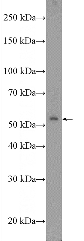 COLO 320 cells were subjected to SDS PAGE followed by western blot with Catalog No:117183(ZNF486 Antibody) at dilution of 1:600