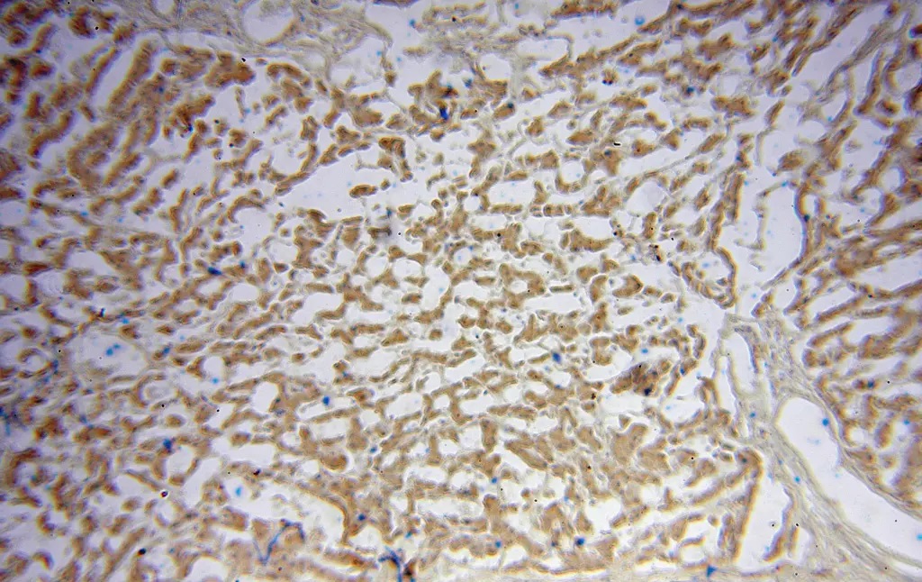 Immunohistochemical of paraffin-embedded human liver using Catalog No:116298(TRIM14 antibody) at dilution of 1:100 (under 10x lens)