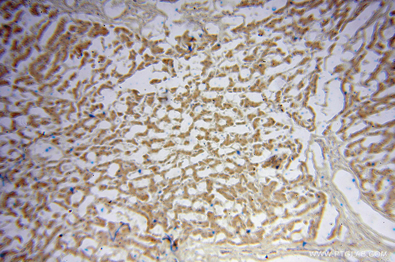 Immunohistochemical of paraffin-embedded human liver using Catalog No:116298(TRIM14 antibody) at dilution of 1:100 (under 10x lens)
