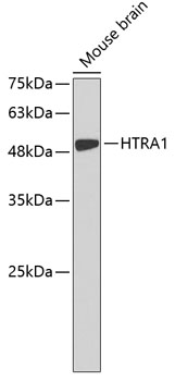 Western blot - HTRA1 Polyclonal Antibody 